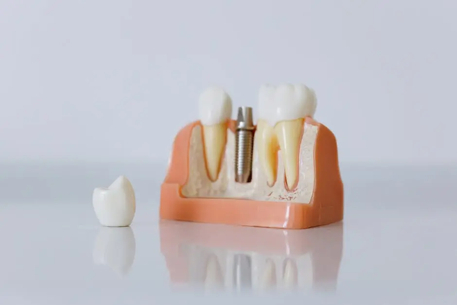 image Dental Crowns in Sugar Land TX | Texan Smile Sugar Land | Dr. Sneha Xavier