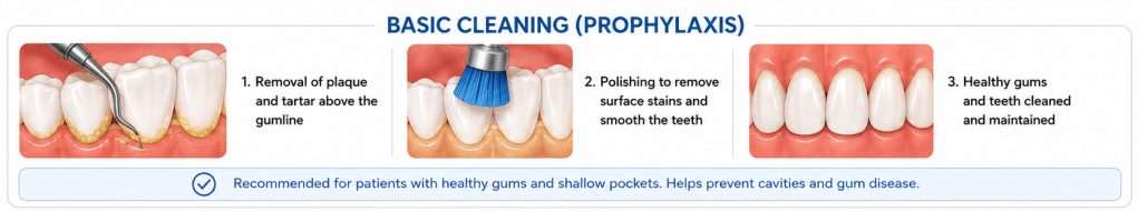 Basic dental cleaning illustration showing preventive cleaning around the teeth and gumline